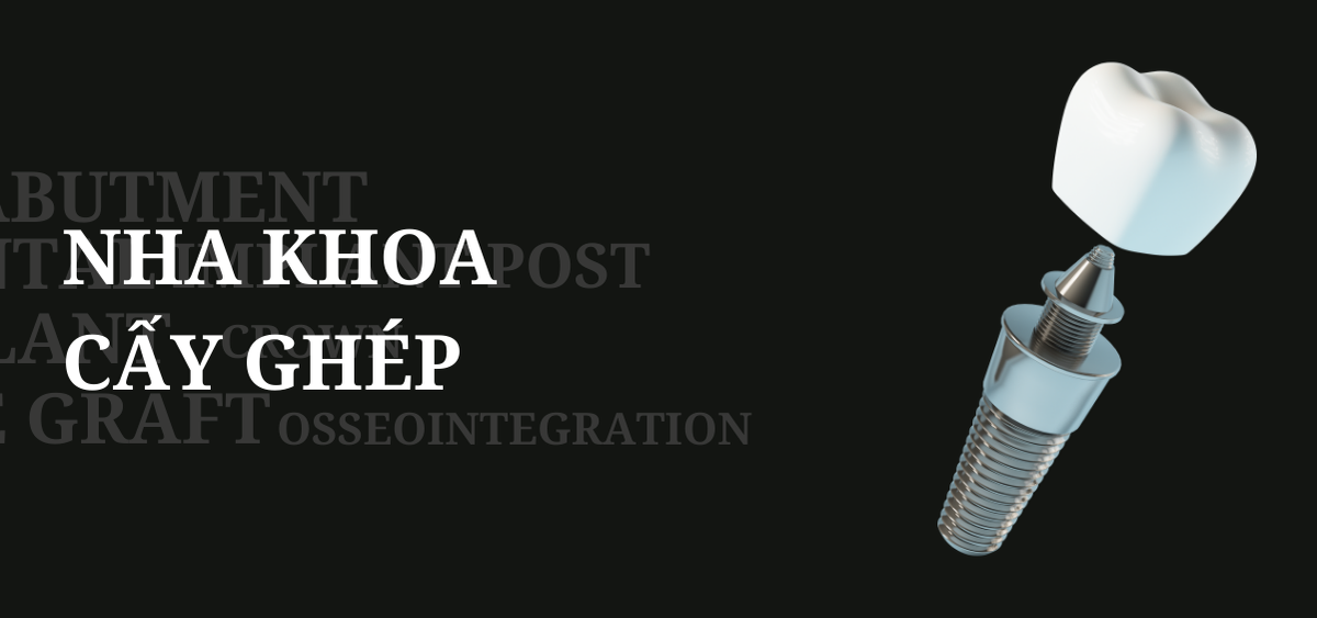 Nha khoa cấy ghép