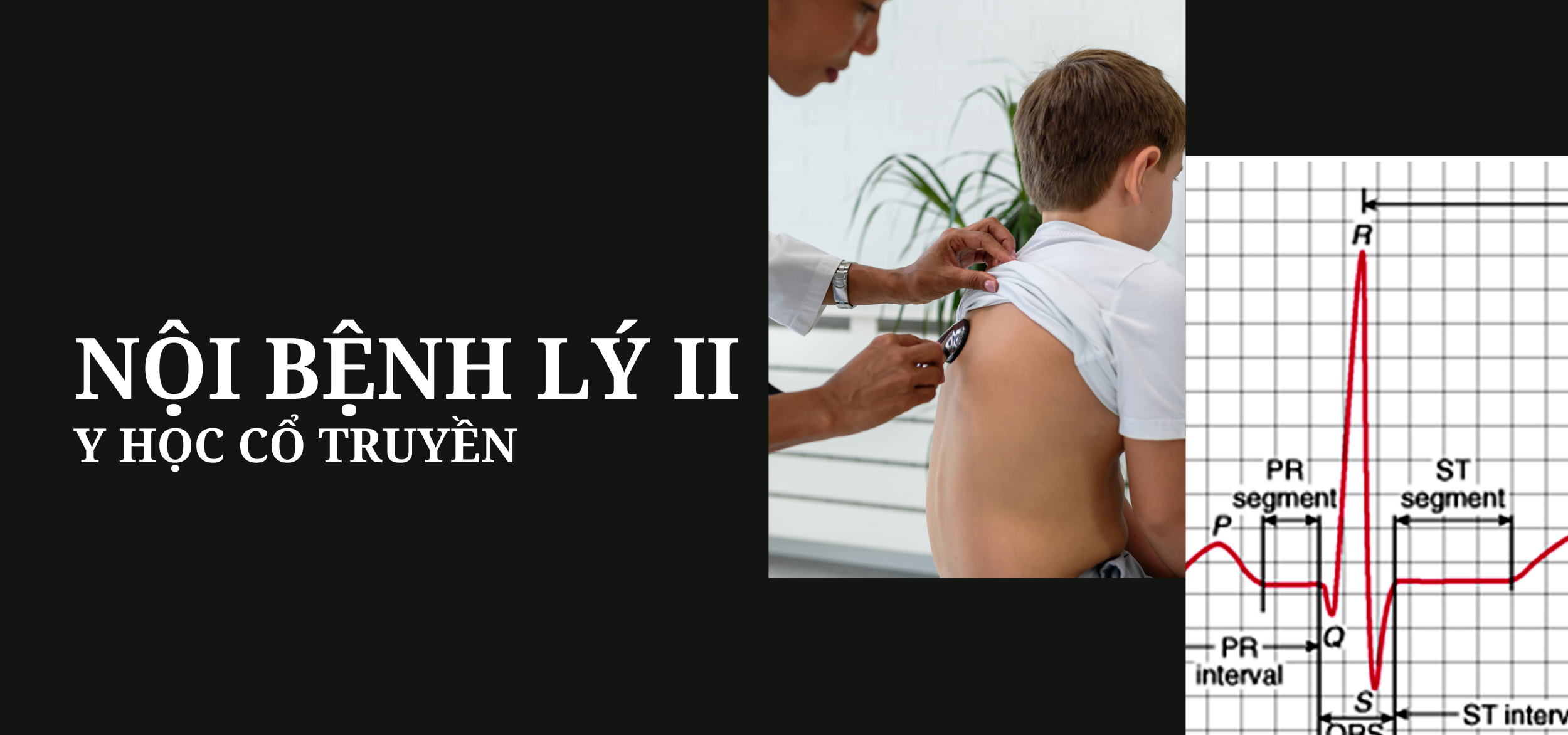 Nội bệnh lý Y học cổ truyền II